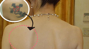 タトゥーカバーのイメージ