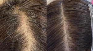 頭皮改善・肌質改善のイメージ